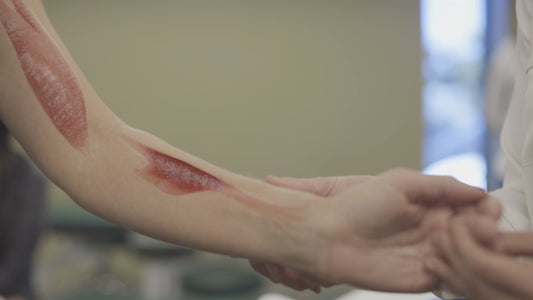 Anterior Forearm Muscle Group